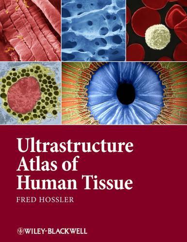 Бумажная книга «Ultrastructure Atlas of Human Tissues», автор Фред Хосслер - фото №1