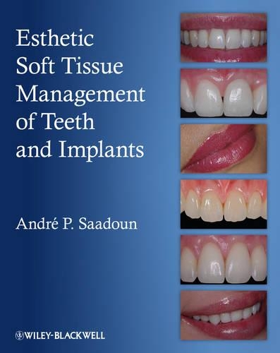 Паперова книга «Esthetic Soft Tissue Management of Teeth and Implants», автор Андре П. Саадун - фото №1