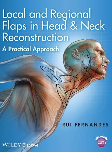 Паперова книга «Local and Regional Flaps in Head and Neck Reconstruction: A Practical Approach», автор Руї Фернандес - фото №1