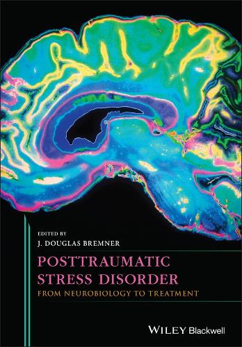 Паперова книга «Posttraumatic Stress Disorder: From Neurobiology to Treatment», автор Дж. Дуглас Бремнер - фото №1