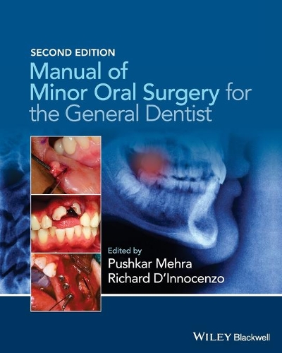 Паперова книга «Manual of Minor Oral Surgery for the General Dentist», авторів Пушкар Мехра, Річард Д'Інноченцо - фото №1