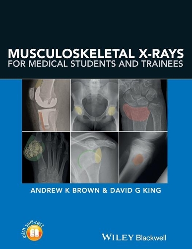 Бумажная книга «Musculoskeletal X-Rays for Medical Students and Trainees», автор Дэвид Г. Кинг - фото №1