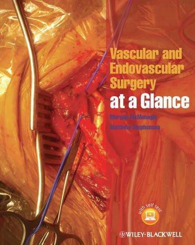 Бумажная книга «Vascular and Endovascular Surgery at a Glance», авторов Мэтью Стивенсон, Морган МакМонагл - фото №1