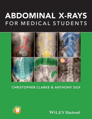 Паперова книга «Abdominal X-rays for Medical Students», авторів Ентоні Дакс, Крістофер Кларк - фото №1