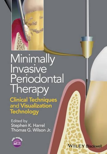 Бумажная книга «Minimally Invasive Periodontal Therapy: Clinical Techniques and Visualization Technology», авторов Стивен К. Харрел, Томас Г. Уилсон - фото №1