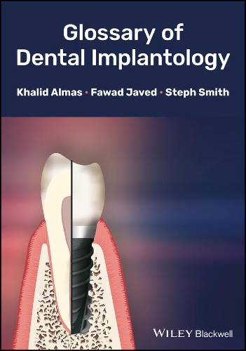 Бумажная книга «Glossary of Dental Implantology», авторов Фавад Джавед, Халид Алмас, Стеф Смит - фото №1