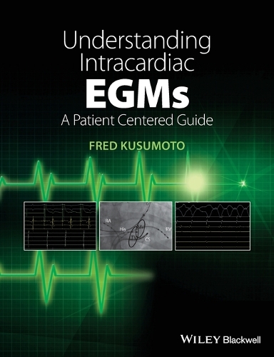 Паперова книга «Understanding Intracardiac EGMs: A Patient Centered Guide», автор Фред М. Кусумото - фото №1
