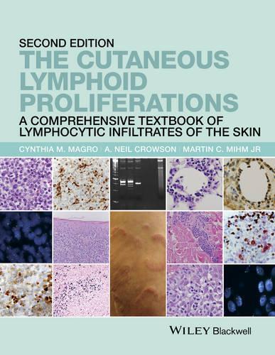 Бумажная книга «The Cutaneous Lymphoid Proliferations: A Comprehensive Textbook of Lymphocytic Infiltrates of the Skin», авторов А. Нил Кроусон, Синтия М. Магро, Мартин К. Мим - фото №1