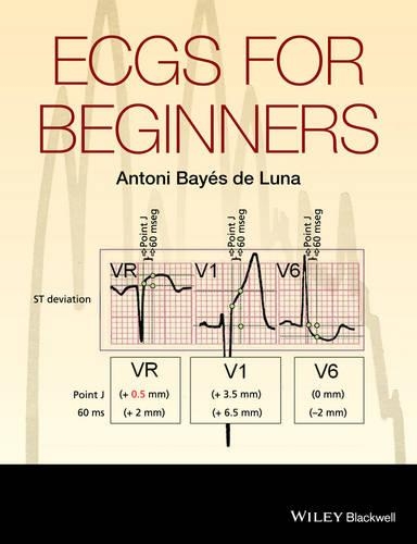 Паперова книга «ECGs for Beginners», автор Антоні Байєс де Луна - фото №1