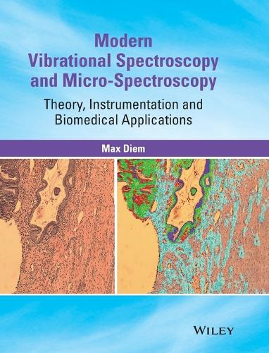 Бумажная книга «Modern Vibrational Spectroscopy and Micro-Spectroscopy: Theory, Instrumentation and Biomedical Applications», автор Макс Дьем - фото №1