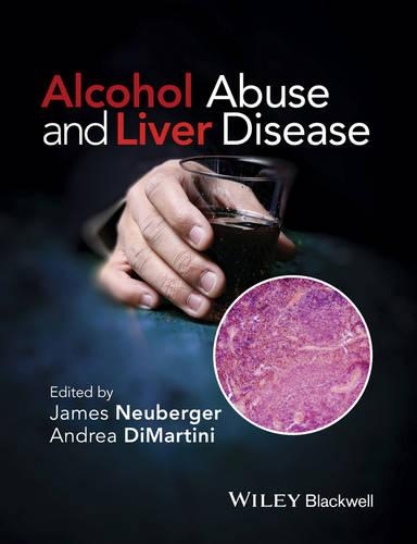 Бумажная книга «Alcohol Abuse and Liver Disease», автор Андреа ДиМартини - фото №1