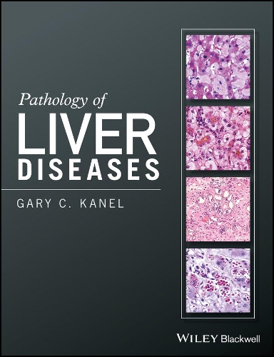 Бумажная книга «Pathology of Liver Diseases», автор Гэри К. Канел - фото №1