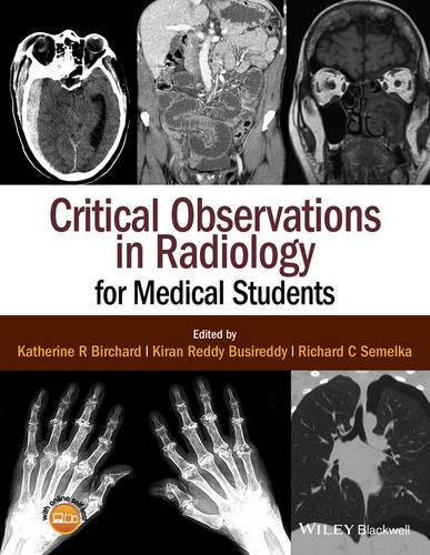Паперова книга «Critical Observations in Radiology for Medical Students», авторів Кетрін Р. Бірчард, Кіран Редді Бусіредді, Річард К. Семелка - фото №1