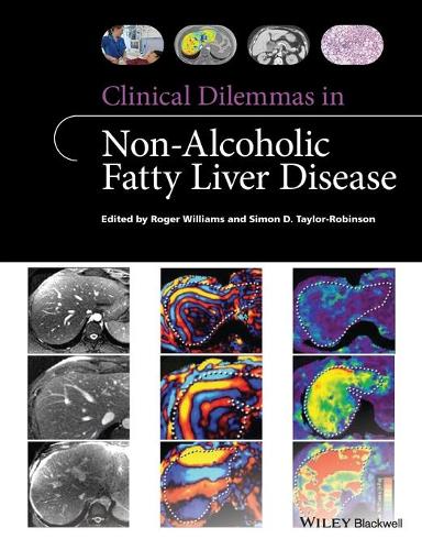 Бумажная книга «Clinical Dilemmas in Non-Alcoholic Fatty Liver Disease», авторов Роджер Уильямс, Саймон Д. Тейлор-Робинсон - фото №1