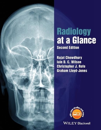Паперова книга «Radiology at a Glance», авторів Крістофер Роуф, Грем Ллойд-Джонс, Ієн Вілсон, Раджат Чаудхурі - фото №1
