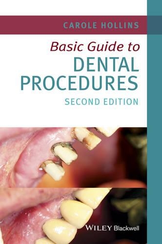 Бумажная книга «Basic Guide to Dental Procedures», автор Кэрол Холлинс - фото №1