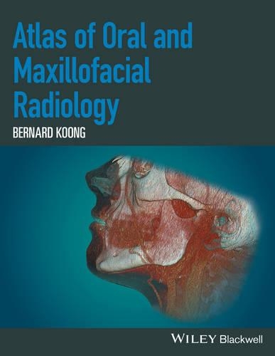 Бумажная книга «Atlas of Oral and Maxillofacial Radiology», автор Бернард Кун - фото №1