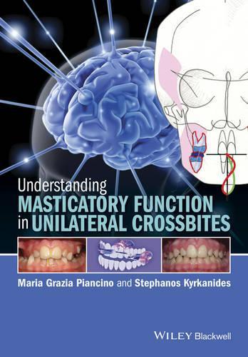 Бумажная книга «Understanding Masticatory Function in Unilateral Crossbites», авторов Мария Грация Пьянчино, Стефанос Кирканидис - фото №1