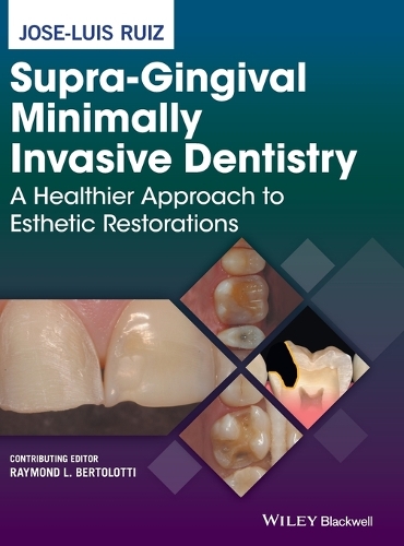 Паперова книга «Supra-Gingival Minimally Invasive Dentistry: A Healthier Approach to Esthetic Restorations», автор Хосе-Луїс Руїс - фото №1