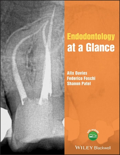 Паперова книга «Endodontology at a Glance», авторів Алікс Девіс, Федеріко Фоскі, Шенон Патель - фото №1