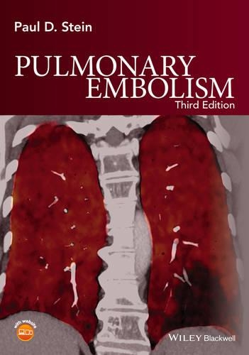 Бумажная книга «Pulmonary Embolism», автор Пол Д. Стайн - фото №1