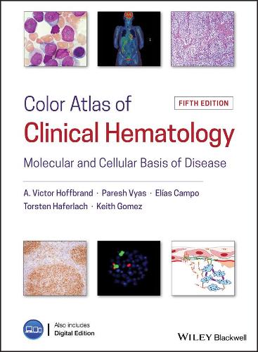 Бумажная книга «Color Atlas of Clinical Hematology: Molecular and Cellular Basis of Disease», авторов Элиас Кампо, Кит Гомес, Пареш Вьяс, Торстен Хаферлах, Виктор Хоффбранд - фото №1