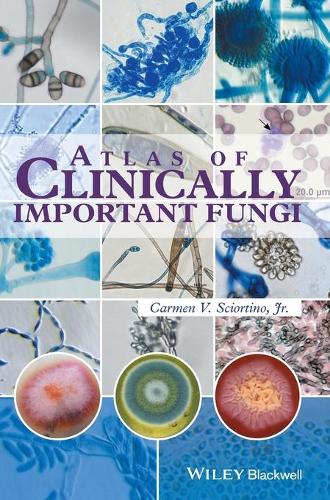 Бумажная книга «Atlas of Clinically Important Fungi», автор Кармен В. Сциортино - фото №1