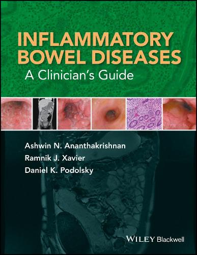 Паперова книга «Inflammatory Bowel Diseases: A Clinician's Guide», авторів Ашвін Н. Анантакрішнан, Деніел К. Подольський, Рамнік Ж. Ксав'єр - фото №1