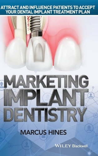 Бумажная книга «Marketing Implant Dentistry: Attract and Influence Patients to Accept Your Dental Implant Treatment Plan», автор Маркус Хайнс - фото №1