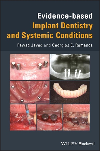 Бумажная книга «Evidence-based Implant Dentistry and Systemic Conditions», авторов Фавад Джавед, Георгиос Э. Романос - фото №1