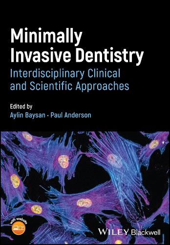 Паперова книга «Minimally Invasive Dentistry: Interdisciplinary Clinical and Scientific Approaches», автор Пол Андерсон - фото №1