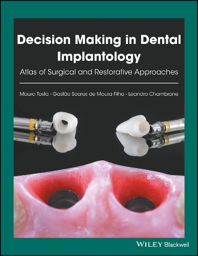 Паперова книга «Decision Making in Dental Implantology: Atlas of Surgical and Restorative Approaches», авторів Гастан Суарес де Моура Фільо, Леандро Шамброне, Мауро Тоста - фото №1