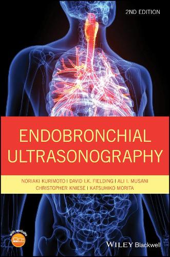 Паперова книга «Endobronchial Ultrasonography», авторів Алі І. Мусані, Крістофер Кнізе, Девід І. К. Філдінг, Кацухіко Моріта, Норіакі Курімото - фото №1