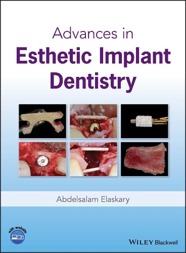 Бумажная книга «Advances in Esthetic Implant Dentistry», автор Абдельсалам Эласкари - фото №1