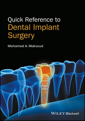 Паперова книга «Quick Reference to Dental Implant Surgery», автор Мохамед А. Максуд - фото №1