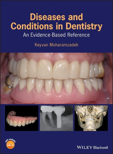 Паперова книга «Diseases and Conditions in Dentistry: An Evidence-Based Reference», автор Кейван Мохарамзаде - фото №1