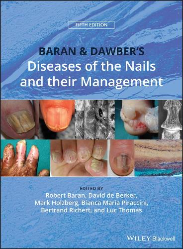 Бумажная книга «Baran and Dawber's Diseases of the Nails and their Management» - фото №1
