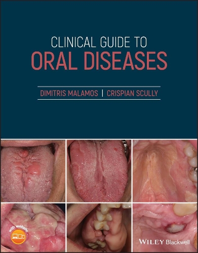 Бумажная книга «Clinical Guide to Oral Diseases», авторов Криспиан Скалли, Димитрис Маламос - фото №1