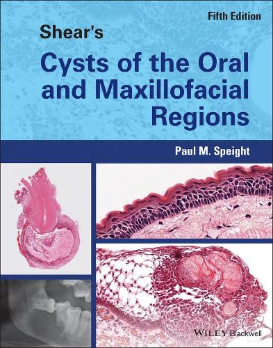 Бумажная книга «Shear's Cysts of the Oral and Maxillofacial Regions», автор Пол М. Спейт - фото №1