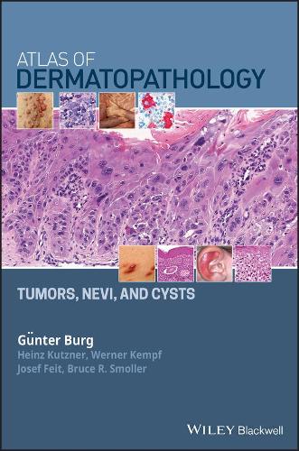 Бумажная книга «Atlas of Dermatopathology: Tumors, Nevi, and Cysts», авторов Брюс Р. Смоллер, Гюнтер Бург, Хайнц Кутцнер, Йозеф Фейт, Вернер Кемпф - фото №1