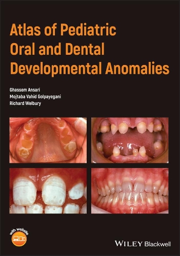 Бумажная книга «Atlas of Pediatric Oral and Dental Developmental Anomalies», авторов Гассем Ансари, Моджтаба Вахид Голпайегани, Ричард Уэлбери - фото №1