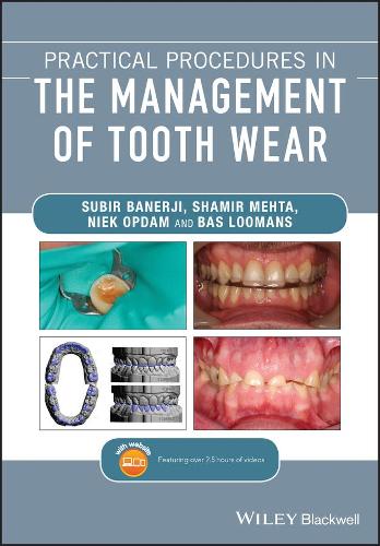 Бумажная книга «Practical Procedures in the Management of Tooth Wear», авторов Бас Луманс, Ниек Опдам, Шамир Б. Мехта, Субир Банерджи - фото №1