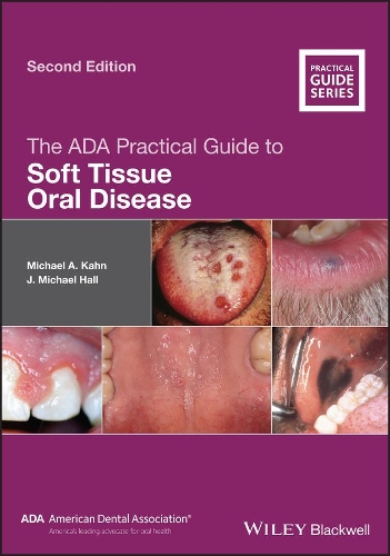 [object Object] «The ADA Practical Guide to Soft Tissue Oral Disease», авторов Дж. Майкл Холл, Майкл А. Кан - фото №1