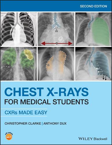 Паперова книга «Chest X-Rays for Medical Students: CXRs Made Easy», авторів Ентоні Дакс, Крістофер Кларк - фото №1
