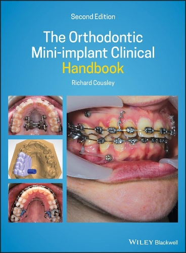 Бумажная книга «The Orthodontic Mini-implant Clinical Handbook», автор Ричард Коусли - фото №1