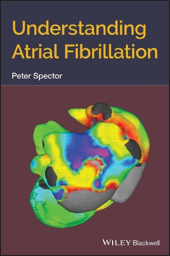 Паперова книга «Understanding Atrial Fibrillation», автор Пітер Спектор - фото №1