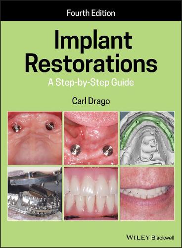 Бумажная книга «Implant Restorations: A Step-by-Step Guide», автор Карл Драго - фото №1