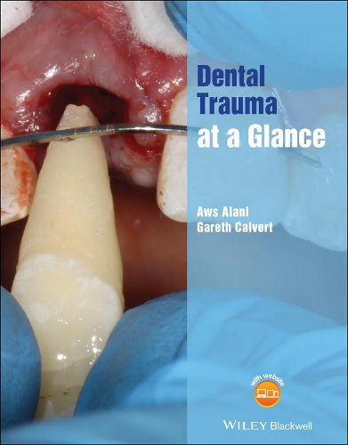 Паперова книга «Dental Trauma at a Glance», авторів Авс Алані, Гарет Калверт - фото №1