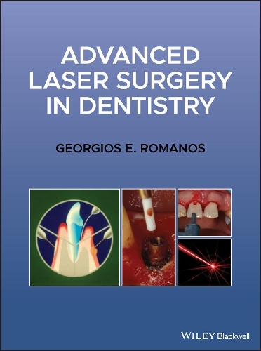 Бумажная книга «Advanced Laser Surgery in Dentistry», автор Георгиос Э. Романос - фото №1