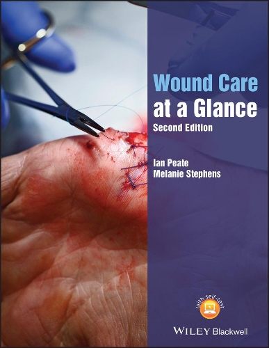 Бумажная книга «Wound Care at a Glance», авторов Ян Пит, Мелани Стивенс - фото №1